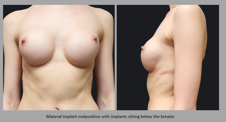 Before and after patient results