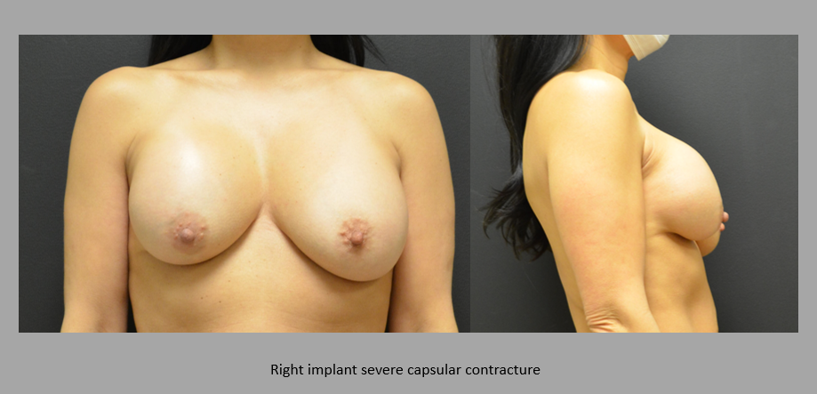 Actual patient results