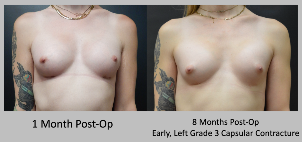 Before and After patient results 4
